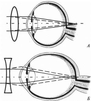 image23